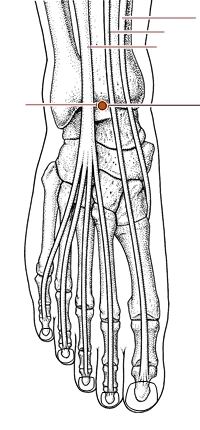 推拿治疗胃脘痛的推拿处方,胃脘痛的针灸处方及操作