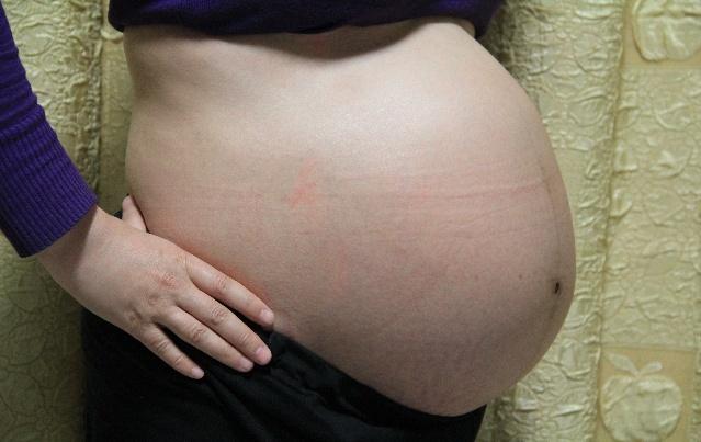 产后上大厕出血怎么办,产妇上厕所大便有血如何处理