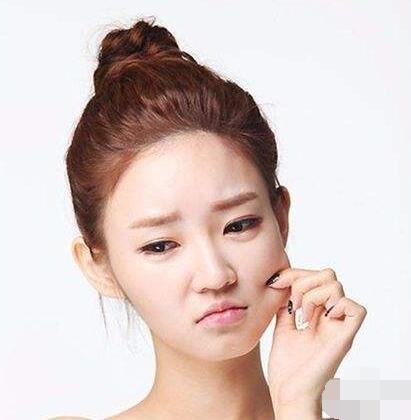 激素脸结痂掉后脸还红是怎么啦,激素脸结痂是属于严重还是轻度