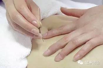 贴士想要A4腰？这里有超全中医饮食减肥法！