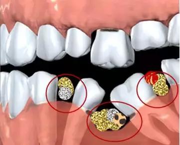 打麻将讲三缺一还是四缺一,打麻将三缺一还是三缺一