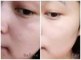 肌肤较干秋冬精华,秋冬不粘腻的精华水