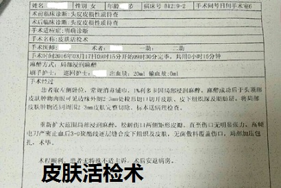 脑袋长疖子的最佳治疗方法,头皮上长了一个火疖子