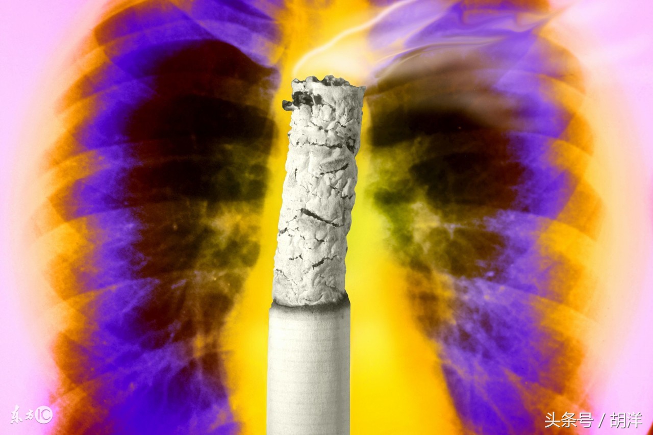 怪病-肺部长得像丝瓜，不但充满大泡小泡，还逐渐硬化，不能伸展