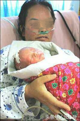 孕妇本以为小小的阴道炎没事竟是胎儿的天敌，害早产宝宝成这样