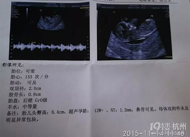 如愿生了个女宝,如愿备孕告捷的记录