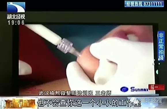 惊爆|深喉揭内幕：武汉所有微整形工作室都是无证经营