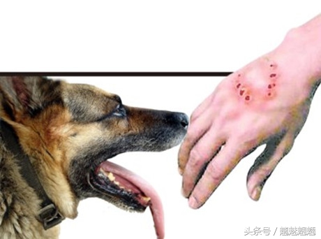 狂犬病传染知识图片,狂犬病最权威知识