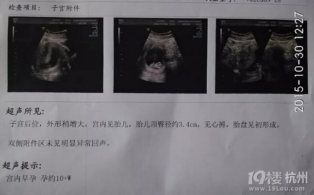 如愿生了个女宝,如愿备孕告捷的记录