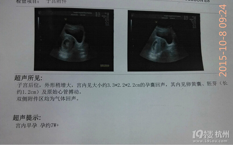 如愿生了个女宝,如愿备孕告捷的记录