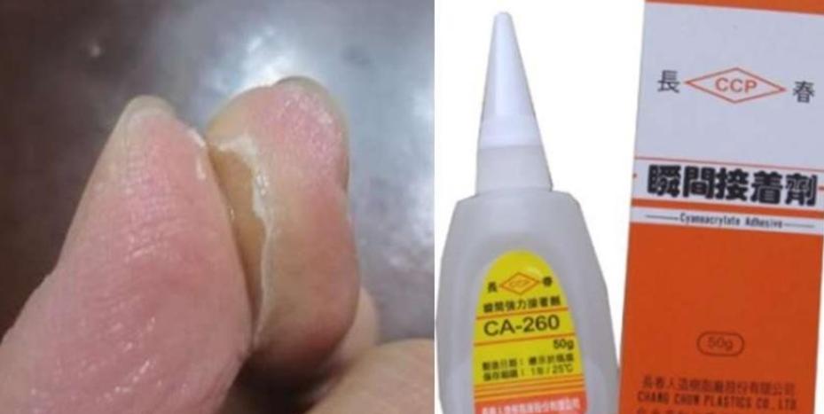 如果被强力胶粘住了怎么解胶,胶水粘住手怎么办小妙招