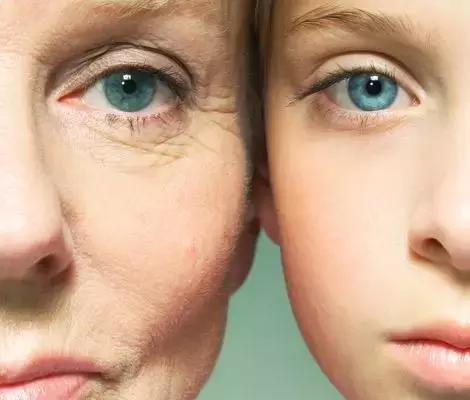 皮肤毛孔出油厉害怎么解决,皮肤出油毛孔大