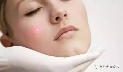 朵嘉浓晓晓敏感肌肤能够美白吗,朵嘉浓晓晓敏感肌肤能美白吗