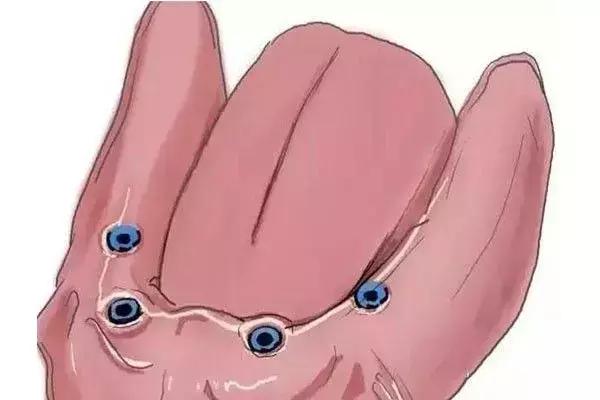 缺牙是种植牙还是烤瓷牙好,烤瓷牙和种植牙哪个保持时间长