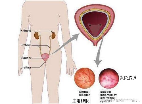 孕期用药一览表,孕期用药有讲究请遵循这4个原则