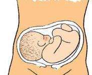 想顺产需要看哪些指数,要想顺产都要做哪些准备工作