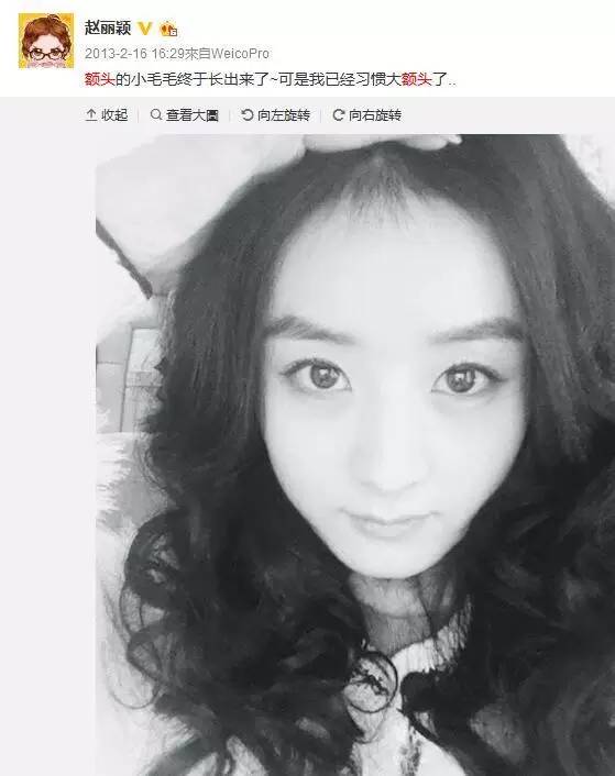 发际线低额头窄赵丽颖,赵丽颖改变的不只是发际线和额头