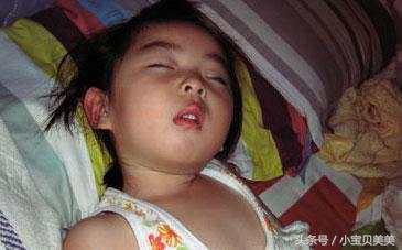 《小儿夹腿综合征》爸爸妈妈注意了！