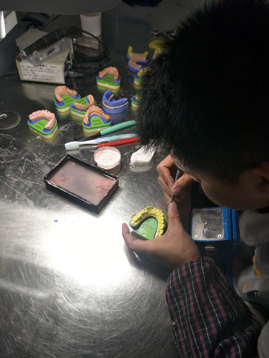 烤瓷牙齿步骤,烤瓷牙齿的做法大全