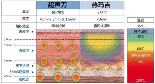 超声刀和热玛吉区别合适人群,热玛吉和超声刀该怎么选