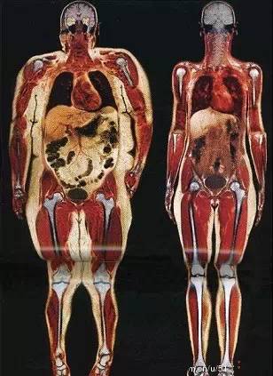 内脏脂肪怎么减下去,怎么减内脏脂肪最快最有效的方法