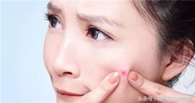 痘痘怎么长出来视频,痘痘怎么快速发出脓包