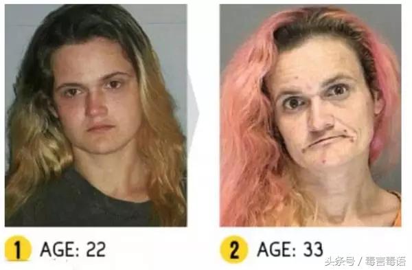 触目惊心吸毒前后真实的变化,吸毒的危害到底有多严重图片