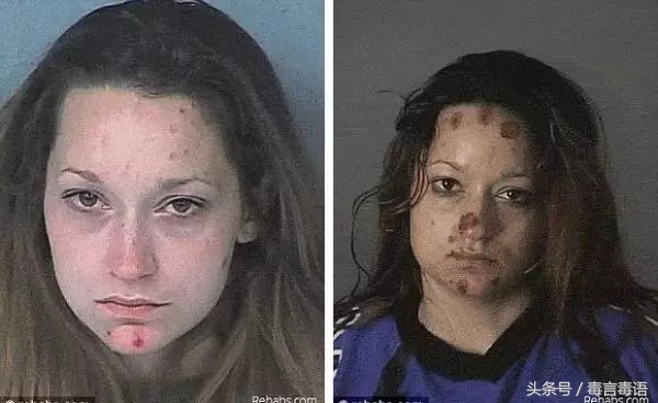 触目惊心吸毒前后真实的变化,吸毒的危害到底有多严重图片