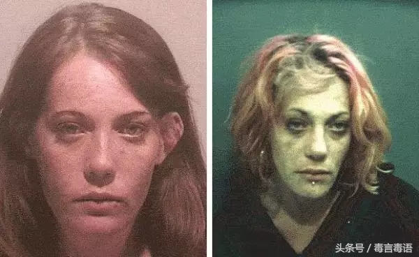 触目惊心吸毒前后真实的变化,吸毒的危害到底有多严重图片