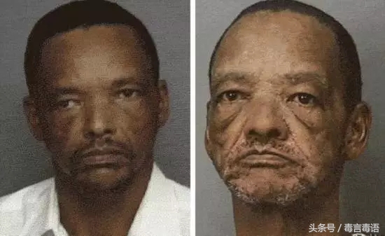 触目惊心吸毒前后真实的变化,吸毒的危害到底有多严重图片