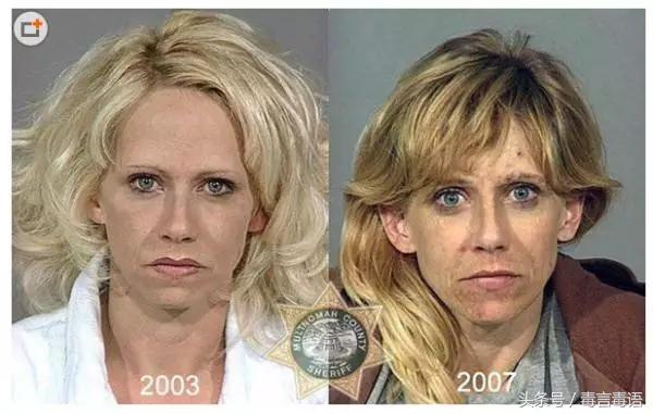 触目惊心吸毒前后真实的变化,吸毒的危害到底有多严重图片