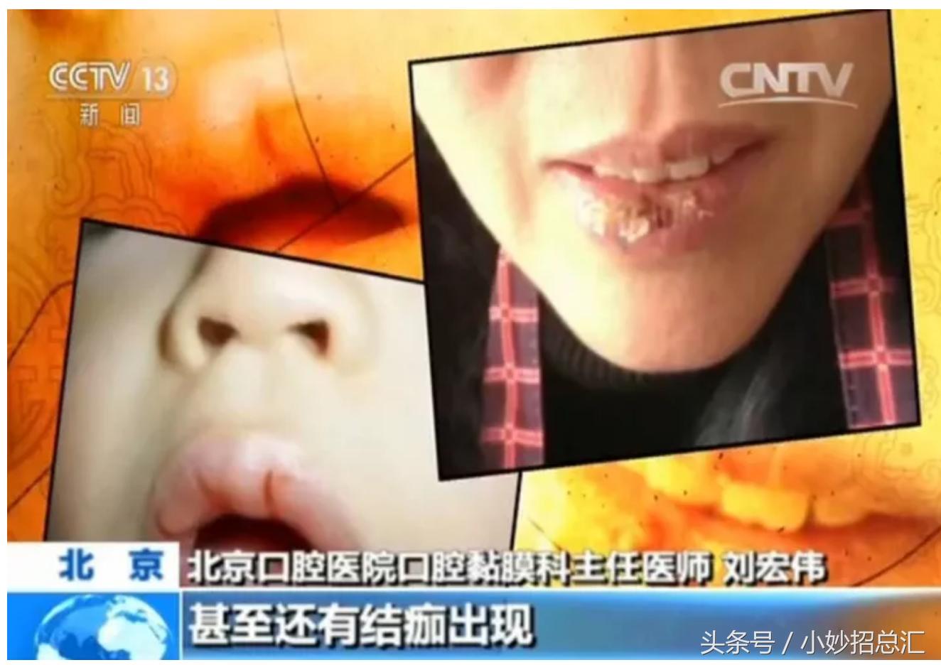 秋冬唇怎么护理,换季唇的正确护理方法