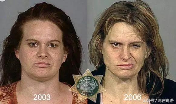 触目惊心吸毒前后真实的变化,吸毒的危害到底有多严重图片