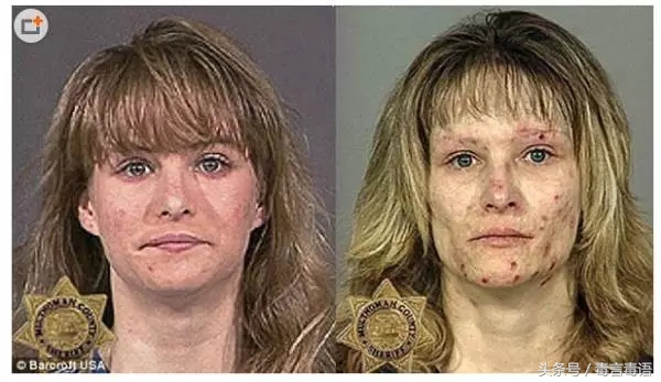 触目惊心吸毒前后真实的变化,吸毒的危害到底有多严重图片