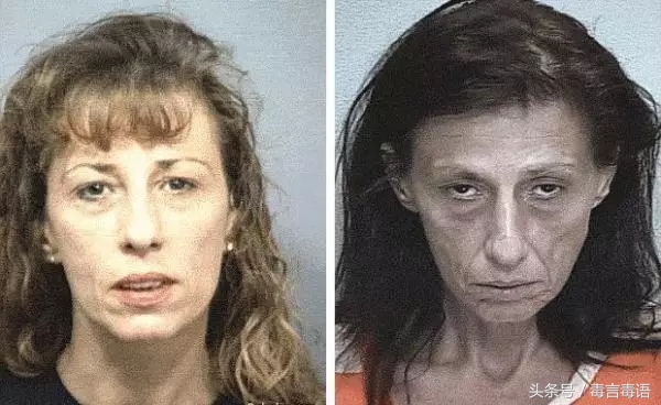 触目惊心吸毒前后真实的变化,吸毒的危害到底有多严重图片