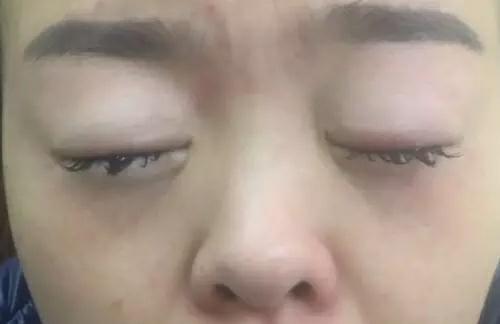 睫毛嫁接流程视频,睫毛嫁接流程操作