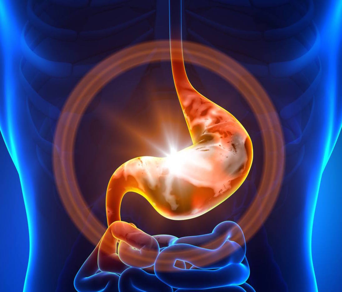 早起跑步胃里反酸,跑步时候胃反酸屁多