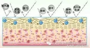 褐斑的最佳治疗方法,褐青斑最佳的治疗方法