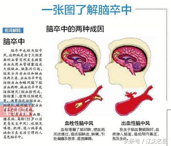 2025年，这个病预计增长3倍！听行家咋警示！