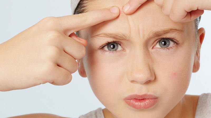 痘痘在同一个位置反复长因为什么,痘痘同个地方反复长怎么解决