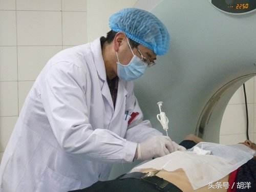 结核菌如何能够确诊,得了结核以哪个检查为准