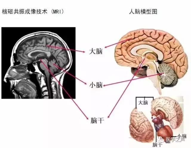 绘制神经系统的生理解剖图,人体骨骼血管神经系统解剖图