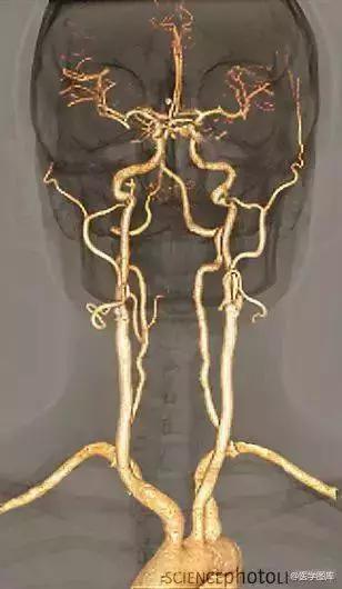 绘制神经系统的生理解剖图,人体骨骼血管神经系统解剖图