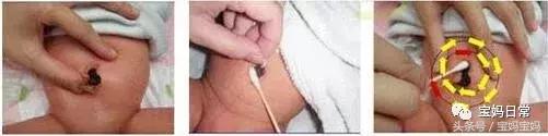 1-7天怎么护理新生儿脐带,新生儿宝妈催乳护理知识大全