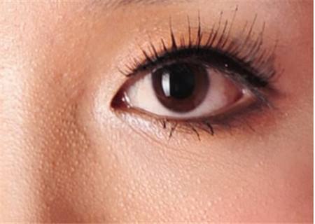 脸上起一片沙粒小疙瘩不痛不痒,天热脸上就长小疙瘩不痛不痒咋办