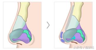 甜美少女养成计——俊翘美鼻
