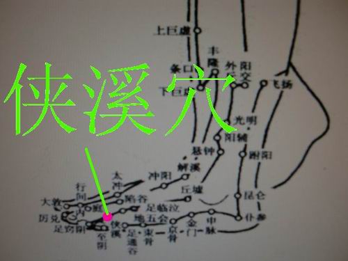 疼痛治疗配穴速记歌诀,人体止疼效果最好的穴