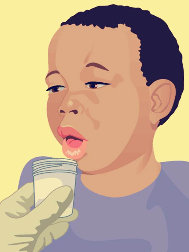 连续咳嗽咯痰是怎么回事,咳嗽后会有一瞬间喘不过气