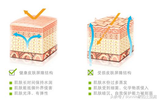 敏感，爆痘，拯救烂脸之乳液篇（实用贴）竟然只要7块钱~