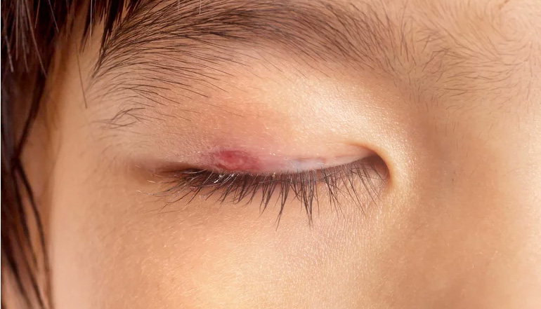 眼睛变红可大可小，眼睛问题都在这里，马上收藏起来